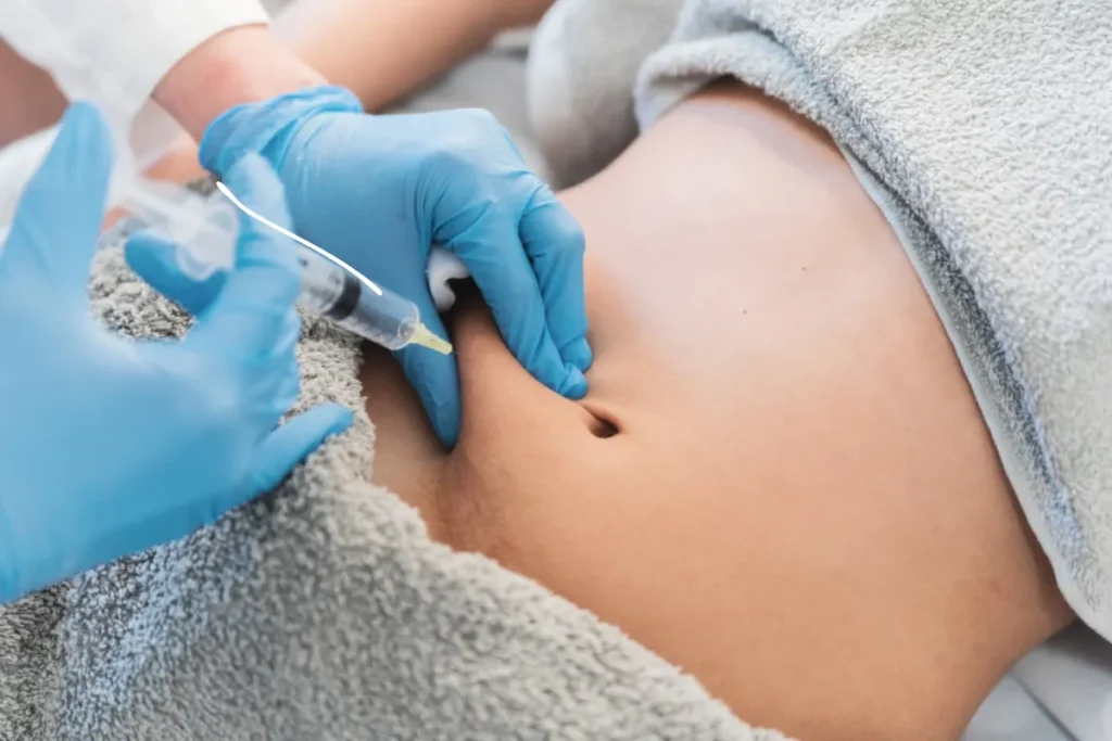 康霈 CBL-514 是什麼?不是瘦瘦針,而是「打針版抽脂」